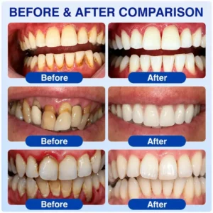 Pheromex® GumRevive Periodontal Care Gel